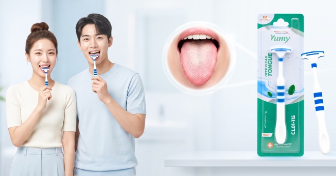 MẢNG BÁM TRẮNG TRÊN LƯỠI: NGUYÊN NHÂN, DẤU HIỆU VÀ CÁCH XỬ LÝ
