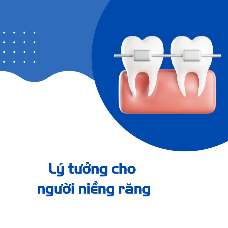 Lý tưởng cho người niềng răng