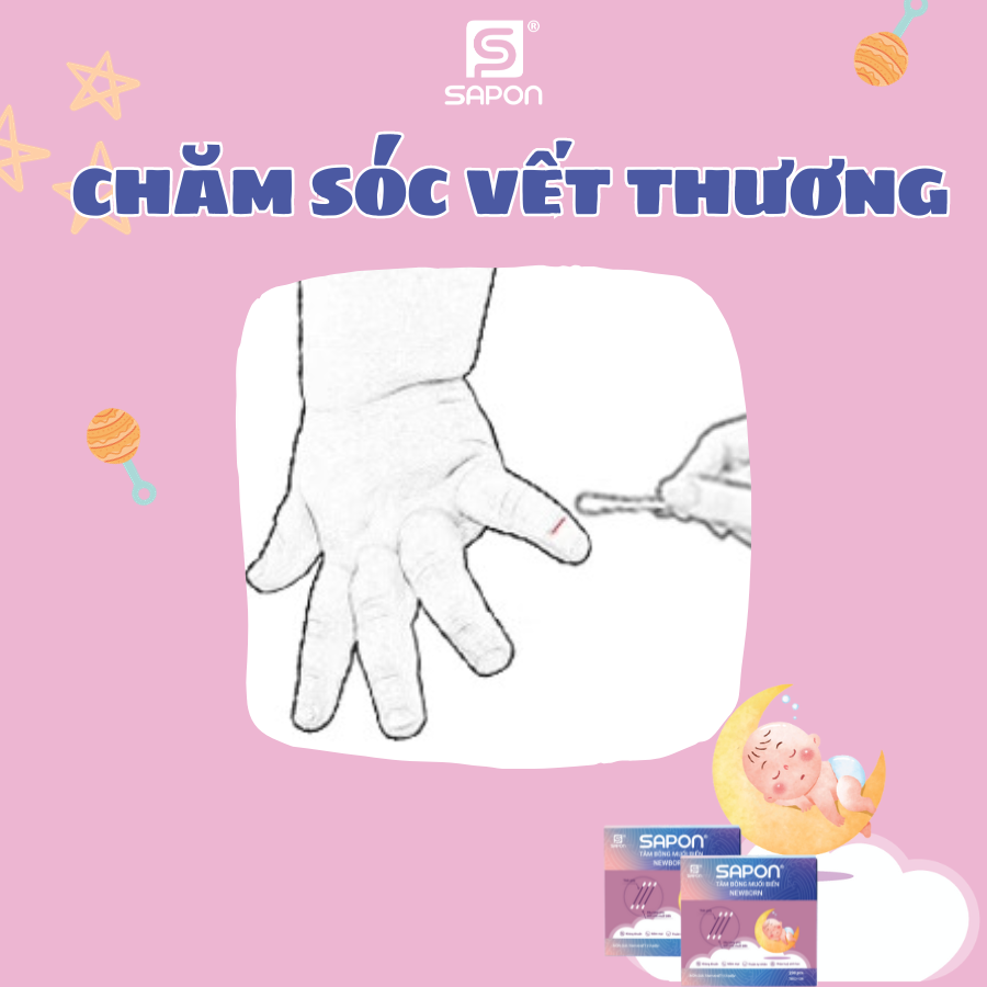 Vệ sinh vết thương