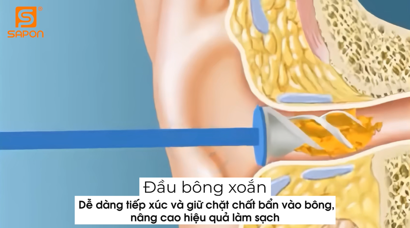 Sử dụng đầu bông xoắn của tăm bông để vệ sinh bên trong ống tai